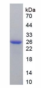 线粒体铁蛋白(FTMT)重组蛋白,Recombinant Ferritin, Mitochondrial (FTMT)