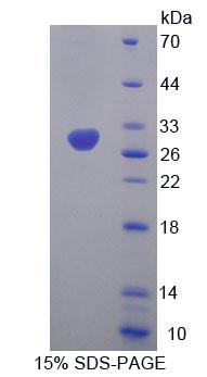 线粒体融合素1(MFN1)重组蛋白,Recombinant Mitofusin 1 (MFN1)