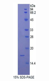 線粒體解偶聯(lián)蛋白2(UCP2)重組蛋白,Recombinant Mitochondrial Uncoupling Protein 2 (UCP2)