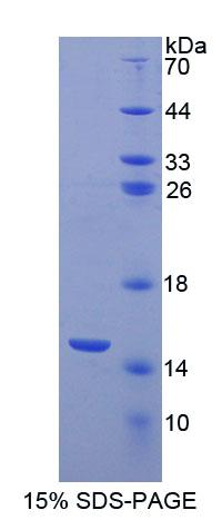 ?；姿崦?(ACYP1)重組蛋白,Recombinant Acylphosphatase 1, Erythrocyte (ACYP1)