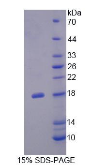 纤连蛋白亮氨酸丰富跨膜蛋白3(FLRT3)重组蛋白,Recombinant Fibronectin Leucine Rich Transmembrane Protein 3 (FLRT3)