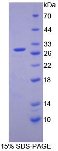 细胞周期素D2(CCND2)重组蛋白,Recombinant Cyclin D2 (CCND2)