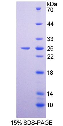 細(xì)胞周期素B(CCNB)重組蛋白,Recombinant Cyclin B (CCNB)