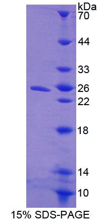 細(xì)胞因子誘導(dǎo)含SH2蛋白(CISH)重組蛋白,Recombinant Cytokine Inducible SH2 Containing Protein (CISH)