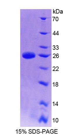 細(xì)胞因子信號(hào)轉(zhuǎn)導(dǎo)抑制因子2(SOCS2)重組蛋白,Recombinant Suppressors Of Cytokine Signaling 2 (SOCS2)