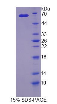 細胞因子受體樣因子1(CRLF1)重組蛋白,Recombinant Cytokine Receptor Like Factor 1 (CRLF1)