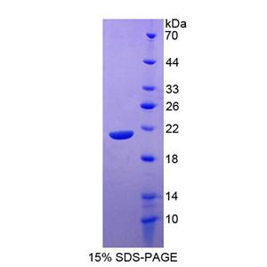 信号淋巴细胞激活分子家族成员7(SLAMF7)重组蛋白