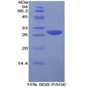 信号淋巴细胞激活分子家族成员1(SLAMF1)重组蛋白