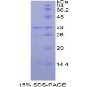 信号传导转录激活因子6(STAT6)重组蛋白