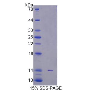 信号传导转录激活因子5A(STAT5A)重组蛋白