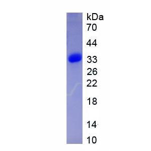 信号传导转录激活因子2(STAT2)重组蛋白,Recombinant Signal Transducer And Activator Of Transcription 2 (STAT2)