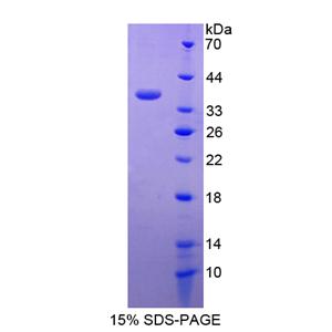 小乳腺表皮粘蛋白(SBEM)重组蛋白