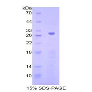 腺苷酸环化酶5(ADCY5)重组蛋白,Recombinant Adenylate Cyclase 5 (ADCY5)