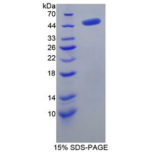 腺苷高半胱氨酸水解酶(AHCY)重组蛋白,Recombinant Adenosylhomocysteinase (AHCY)