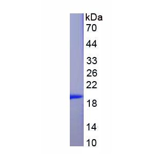 腺苷A2b受体(ADORA2b)重组蛋白,Recombinant Adenosine A2b Receptor (ADORA2b)