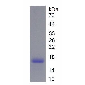 腺苷A2a受体(ADORA2a)重组蛋白