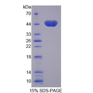 线粒体肌酸激酶2(CKMT2)重组蛋白,Recombinant Creatine Kinase, Mitochondrial 2, Sarcomeric (CKMT2)