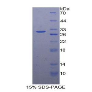 纤溶酶原激活物抑制因子2(PAI2)重组蛋白,Recombinant Plasminogen Activator Inhibitor 2 (PAI2)