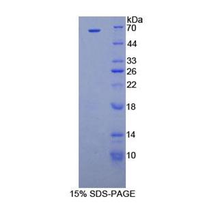 细胞周期素D1(CCND1)重组蛋白