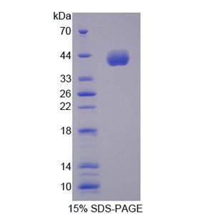 細(xì)胞周期素B2(CCNB2)重組蛋白