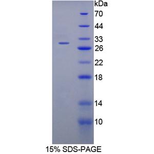 細(xì)胞增殖上調(diào)節(jié)因子(URGCP)重組蛋白