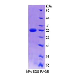 细胞因子信号转导抑制因子2(SOCS2)重组蛋白
