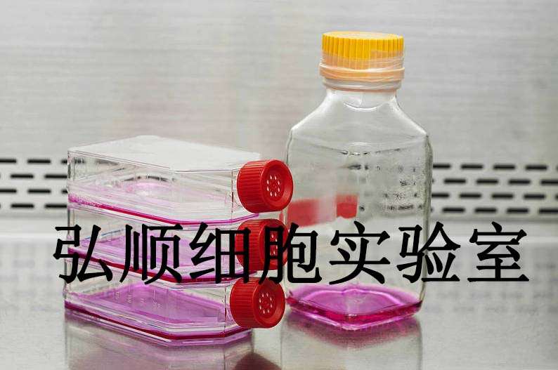 NCM356 Cells|结直肠腺癌贴壁细胞,NCM356 Cells