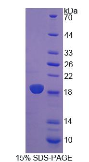 细胞维甲酸结合蛋白2(CRABP2)重组蛋白,Recombinant Cellular Retinoic Acid Binding Protein 2 (CRABP2)