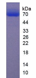 細(xì)胞外基質(zhì)蛋白1(ECM1)重組蛋白,Recombinant Extracellular Matrix Protein 1 (ECM1)