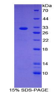 细胞死亡诱导DFFA样效应蛋白C(CIDEC)重组蛋白,Recombinant Cell Death Inducing DFFA Like Effector C (CIDEC)