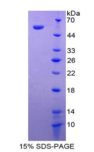細胞死亡誘導DFFA樣效應蛋白A(CIDEA)重組蛋白,Recombinant Cell Death Inducing DFFA Like Effector A (CIDEA)
