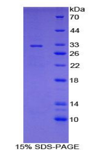 细胞色素P450家族成员7A1(CYP7A1)重组蛋白,Recombinant Cytochrome P450 7A1 (CYP7A1)