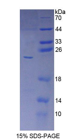 细胞色素P450家族成员5A1(CYP5A1)重组蛋白,Recombinant Cytochrome P450 5A1 (CYP5A1)