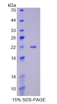 细胞色素P450家族成员3A4(CYP3A4)重组蛋白,Recombinant Cytochrome P450 3A4 (CYP3A4)