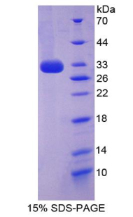 细胞色素P450家族成员27B1(CYP27B1)重组蛋白,Recombinant Cytochrome P450 27B1 (CYP27B1)