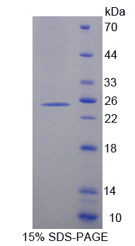 細(xì)胞色素P450家族成員26A1(CYP26A1)重組蛋白,Recombinant Cytochrome P450 26A1 (CYP26A1)