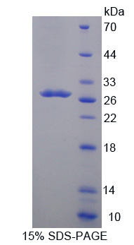 细胞色素P450家族成员24A1(CYP24A1)重组蛋白,Recombinant Cytochrome P450 24A1 (CYP24A1)