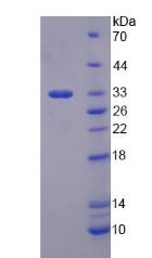 细胞色素P450家族成员1A2(CYP1A2)重组蛋白,Recombinant Cytochrome P450 1A2 (CYP1A2)