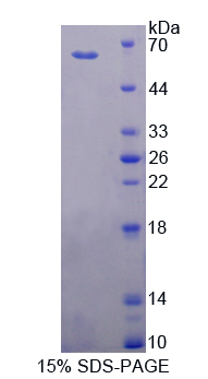 细胞色素P450家族成员11B1(CYP11B1)重组蛋白,Recombinant Cytochrome P450 11B1 (CYP11B1)