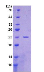 細胞角蛋白19片段抗原21-1(CYFRA21-1)重組蛋白,Recombinant Cytokeratin Fragment Antigen 21-1 (CYFRA21-1)