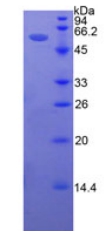 细胞间粘附分子5(ICAM5)重组蛋白,Recombinant Intercellular Adhesion Molecule 5 (ICAM5)