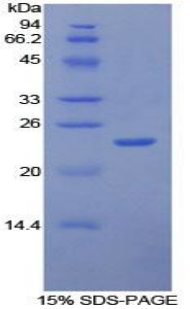 细胞间粘附分子4(ICAM4)重组蛋白,Recombinant Intercellular Adhesion Molecule 4 (ICAM4)