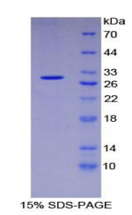 细胞间粘附分子3(ICAM3)重组蛋白,Recombinant Intercellular Adhesion Molecule 3 (ICAM3)