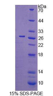 细胞分裂周期因子42(CDC42)重组蛋白,Recombinant Cell Division Cycle Protein 42 (CDC42)