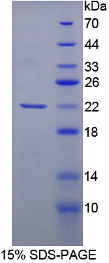 细胞分裂周期因子25(CDC25)重组蛋白,Recombinant Cell Division Cycle Protein 25 (CDC25)