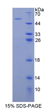 细胞程序性死亡蛋白6相互作用蛋白(PDCD6IP)重组蛋白,Recombinant Programmed Cell Death Protein 6 Interacting Protein (PDCD6IP)