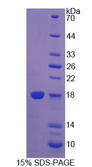 细胞程序性死亡蛋白5(PDCD5)重组蛋白,Recombinant Programmed Cell Death Protein 5 (PDCD5)