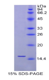硒蛋白X1(SEPX1)重组蛋白,Recombinant Selenoprotein X1 (SEPX1)