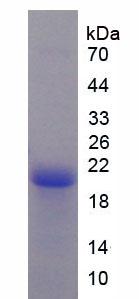 吸引素(ATRN)重组蛋白,Recombinant Attractin (ATRN)