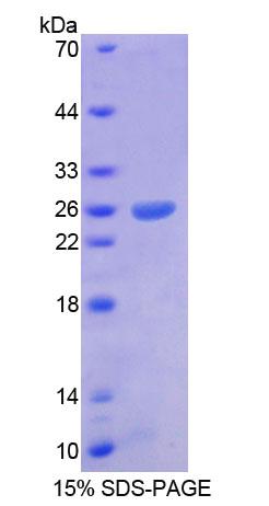 无芒相关同源框蛋白(ARX)重组蛋白,Recombinant Aristaless Related Homeobox Protein (ARX)